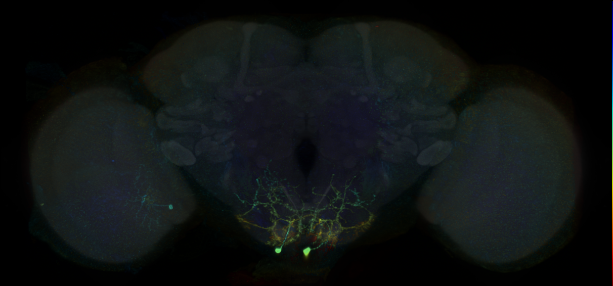 descending neuron of the gnathal ganglion